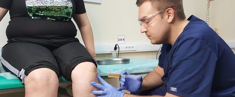 Ein Orthopäde führt bei Arthrose eine intraartikuläre Injektion in das Kniegelenk durch