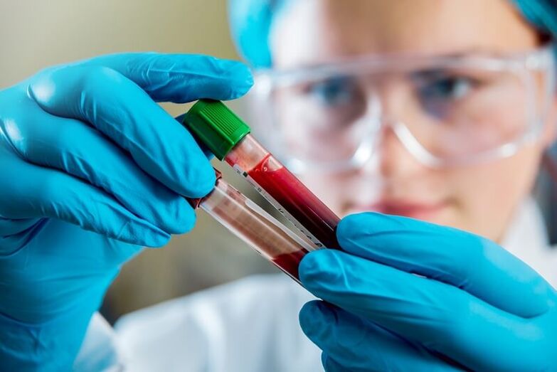 Vollständiger Bluttest zur Diagnose von Rückenschmerzen