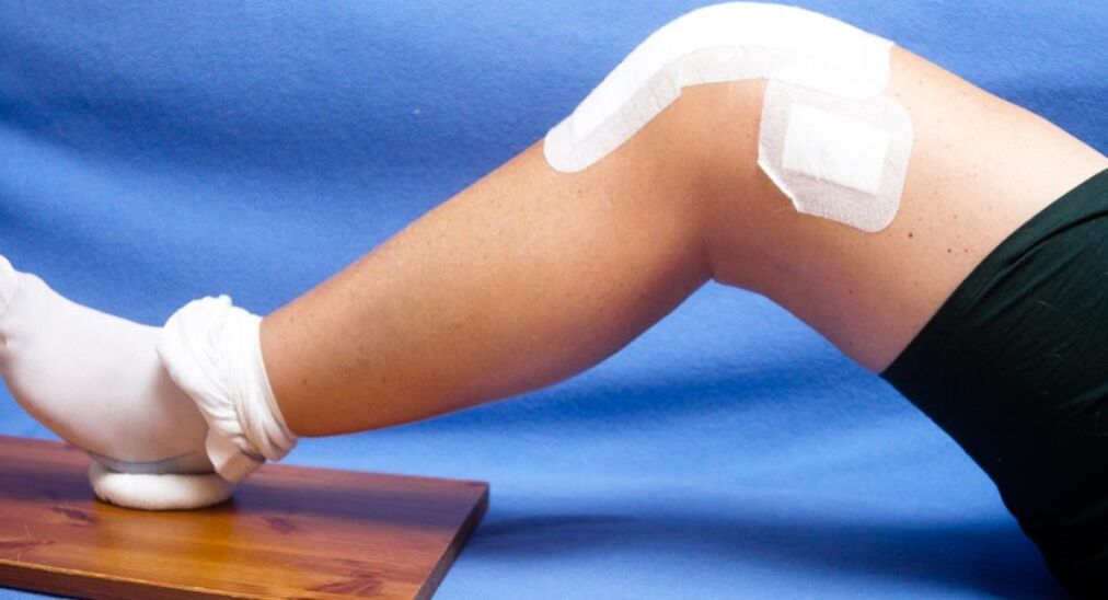 Eine Verletzung des Kniegelenks ist eine der Ursachen für die Entstehung einer Arthrose